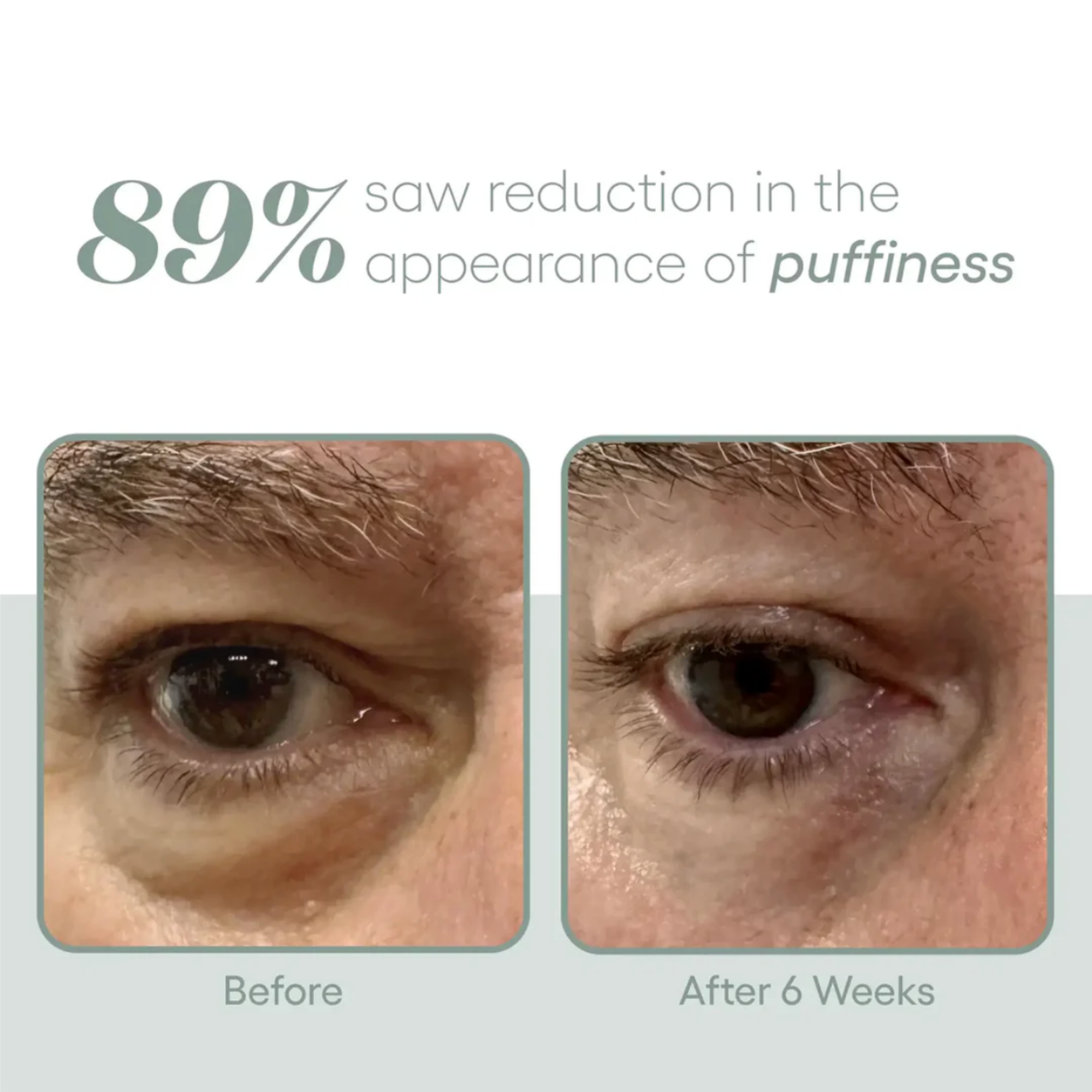 (plated) EYE Serum
