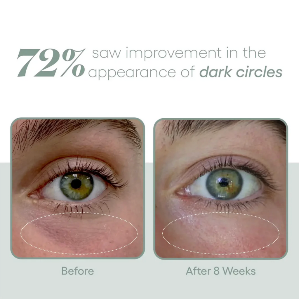(plated) EYE Serum