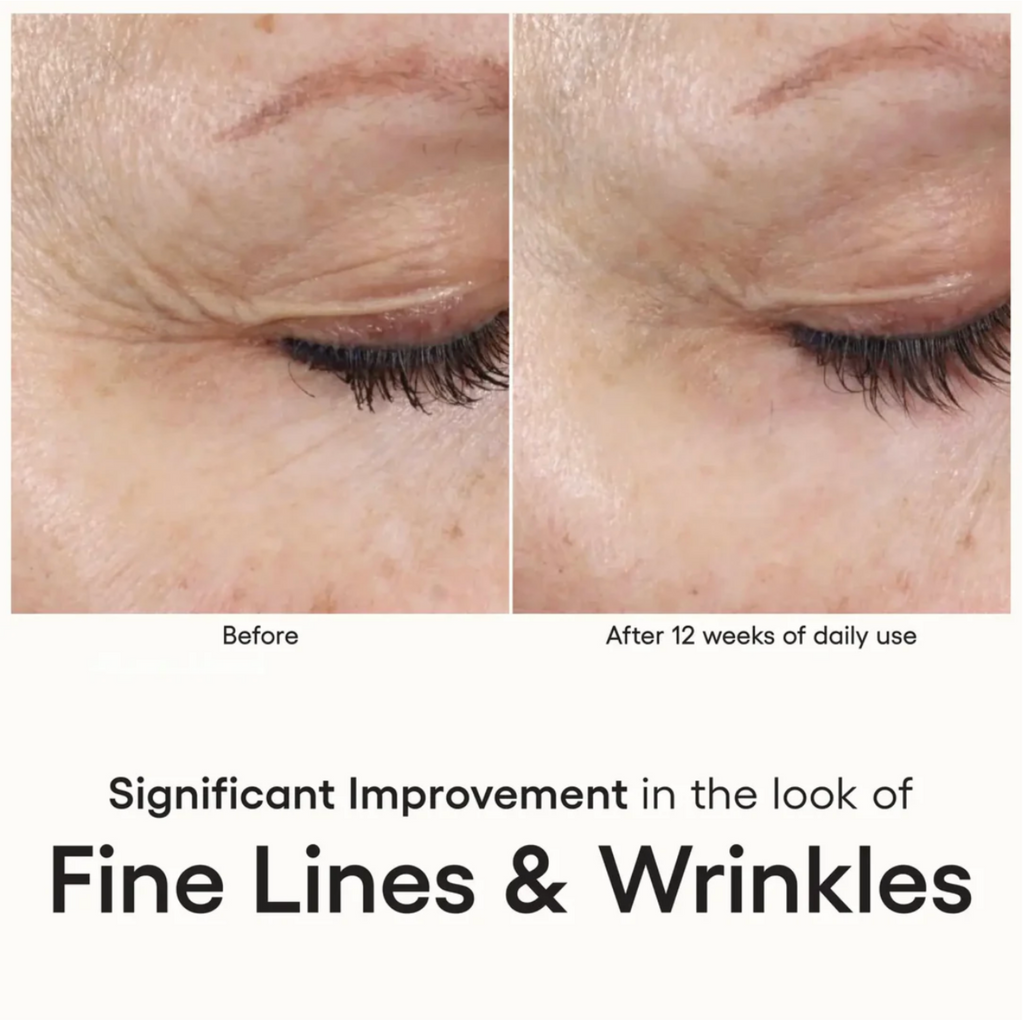 (plated) EYE Serum