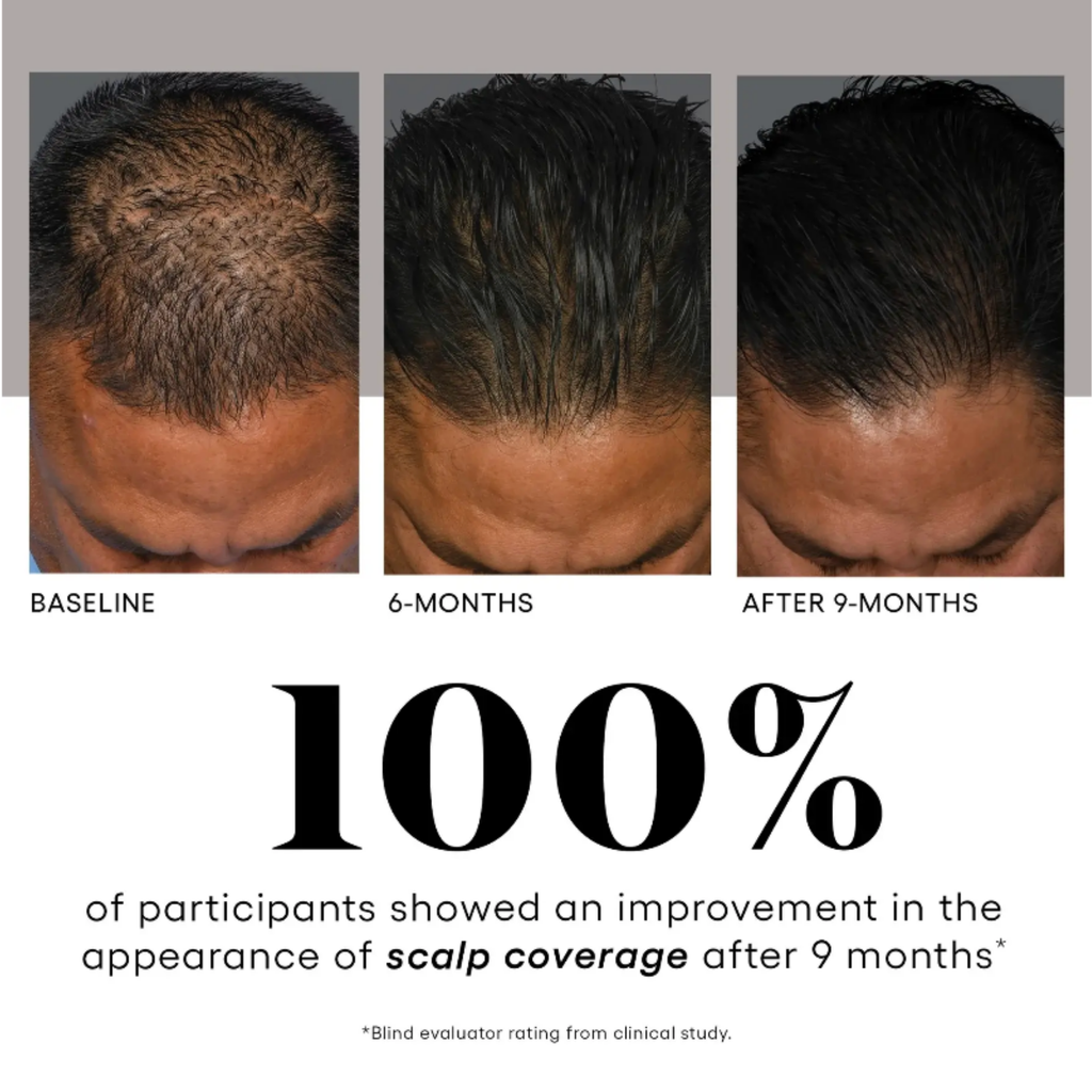 (plated) HAIR Serum