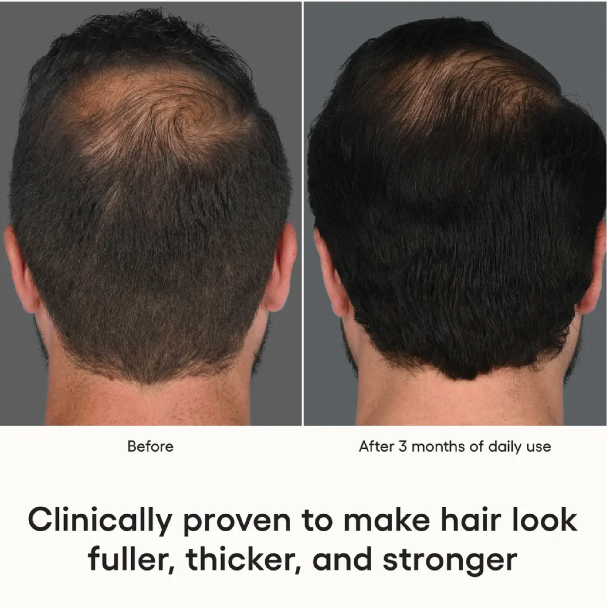 (plated) HAIR Serum